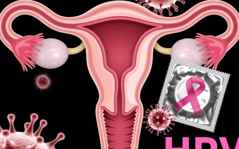 安全套防宫颈癌数据，真的有效吗？能降低多少风险？